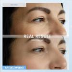 Retinol Eye Cream for Dark Circles and Wrinkles