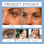 Eye Cream for Puffiness and Dark Circles