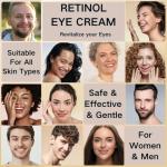 Retinol Eye Cream for Dark Circles & Puffiness