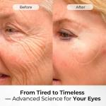 Instant Eye Tightener for Dark Circles and Puffiness