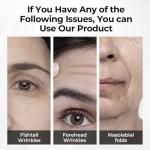 Instant Eye Tightener for Dark Circles and Puffiness