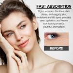 Retinol Eye Stick for Dark Circles and Puffiness