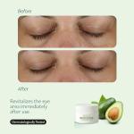 Sinoz Avocado Eye Cream for Dark Circles