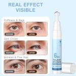 6 in 1 Collagen Under Eye Cream with Roller