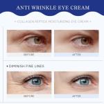 Hydrating Collagen Eye Cream for Dark Circles