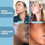 Eva Naturals Vitamin C+ Anti-Aging Facial Serum