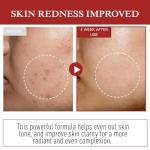 Centella Anti-Aging Moisturizer for Radiant Skin