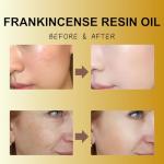 Frankincense Face Oil Duo for Youthful Skin