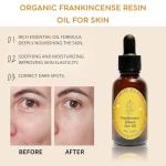 Frankincense Oil Serum for Youthful Skin