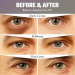 Men’s Bakuchiol Under Eye Gel Patches for Puffiness