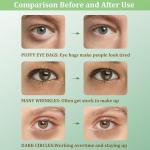 Avocado Collagen Under Eye Patches - 30 Pairs