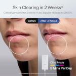 Ulike ReGlow LED Face Mask for Skin Renewal