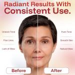 Thermolab Wireless Red Light Therapy Face Mask