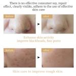 Revitalight LED Face Mask for Anti-Aging Rejuvenation