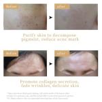 Revitalight LED Face Mask for Anti-Aging Rejuvenation