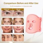 Mlriyl LED Face Mask for Anti-Aging & Rejuvenation