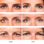 Vitamin C & E Moisturizer for Youthful Skin