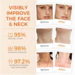 OUKEYA Collagen Face Cream - Anti-Aging Moisturizer