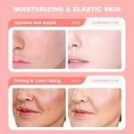 Hydrating Collagen Cream for Youthful Skin