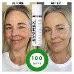 Evonex Age Defying Foundation and Serum Combo
