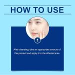 Retinol Gel: Acne Treatment & Anti-Aging Cream