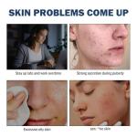 Retinol Gel: Acne Treatment & Anti-Aging Cream