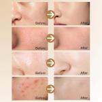 Korean Ginseng & Rice Anti-Aging Skin Care Set