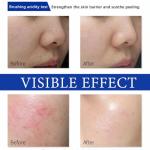 Boto-x Face Serum for Youthful, Hydrated Skin