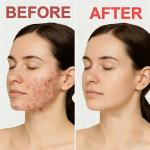 Angel Silk Exfoliating Pads for Clear Skin