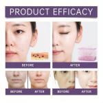 20% Niacinamide Serum with Zinc for Anti-Aging