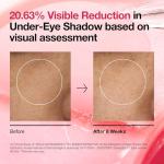 ANUA Niacinamide Toner Pads for Radiant Skin