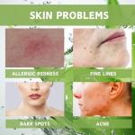 18PCS Aloe Vera Beauty Gift Set for Women