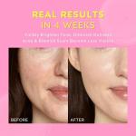 5-IN-1 Glow Skin Care Set for Teens