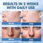 PDRN Peptide Serum for Firmer, Radiant Skin