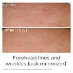 Elizabeth Arden Prevage Anti-Aging Serum 50ml