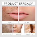 Paracress Anti-Aging Facial Oil with Vitamin E