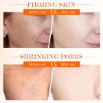 Vitamin C Retinol Face Cream for Anti-Aging