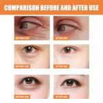 Vitamin C Eye Cream Stick for Dark Circles