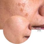 Revox B77 Vitamin C Serum - Brighten & Protect