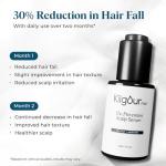KilgourMD Scalp Serum for Hair Loss and Anti-Aging