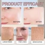 Micro Infusion Face Kit with Collagen & Hyaluronic Acid