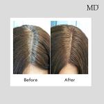 MD Color Restoration Anti-Aging Hair Serum