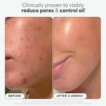 Paula's Choice 2% BHA Liquid Exfoliant 118ml