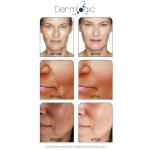 Dermlogic Anti-Aging Peel Pads with Exfoliating Ingredients