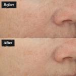 Kiehl's Vitamin C Serum for Youthful Skin