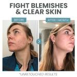 Brightening Vitamin C Serum with Salicylic Acid