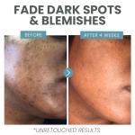 Brightening Vitamin C Serum with Salicylic Acid