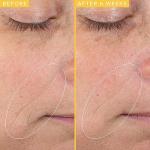 Farmacy Honeymoon Glow Night Serum for Youthful Skin