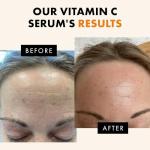 Vitamin C Anti-Aging Serum for Face and Neck