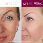 Retinol Anti-Aging Facial Cleanser for Smooth Skin